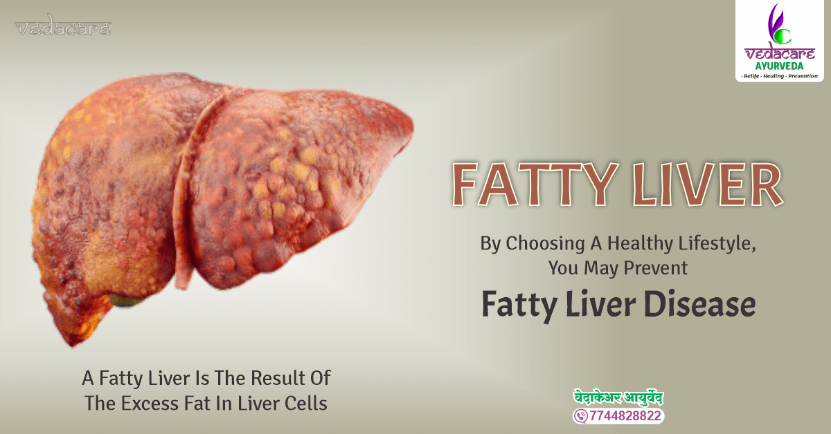 ayurvedic treatment for fatty liver