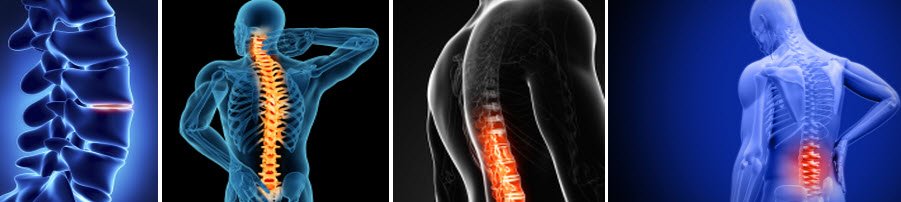 ayurvedic treatment for spine