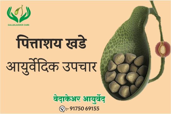 पित्ताशय खडे आयुर्वेदिक उपचार