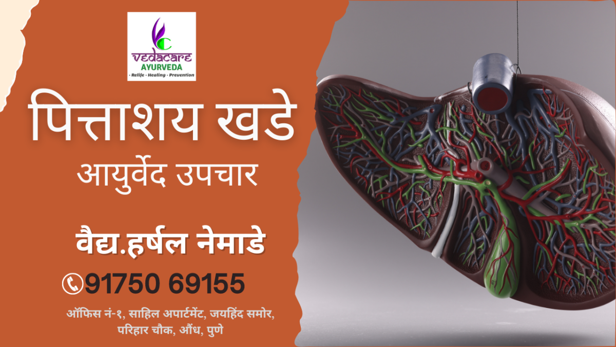 पित्ताशय खडे आयुर्वेदिक उपचार